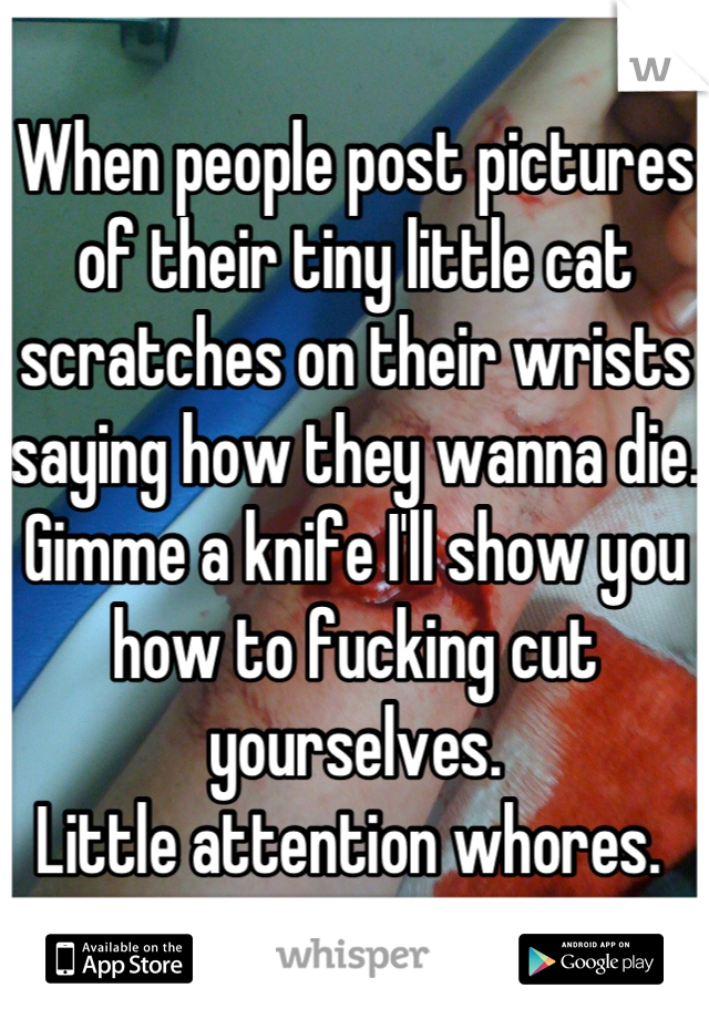 When people post pictures of their tiny little cat scratches on their wrists saying how they wanna die. 
Gimme a knife I'll show you how to fucking cut yourselves. 
Little attention whores. 