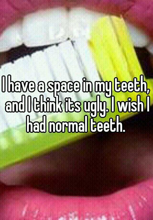 I have a space in my teeth, and I think its ugly. I wish I had normal teeth. 