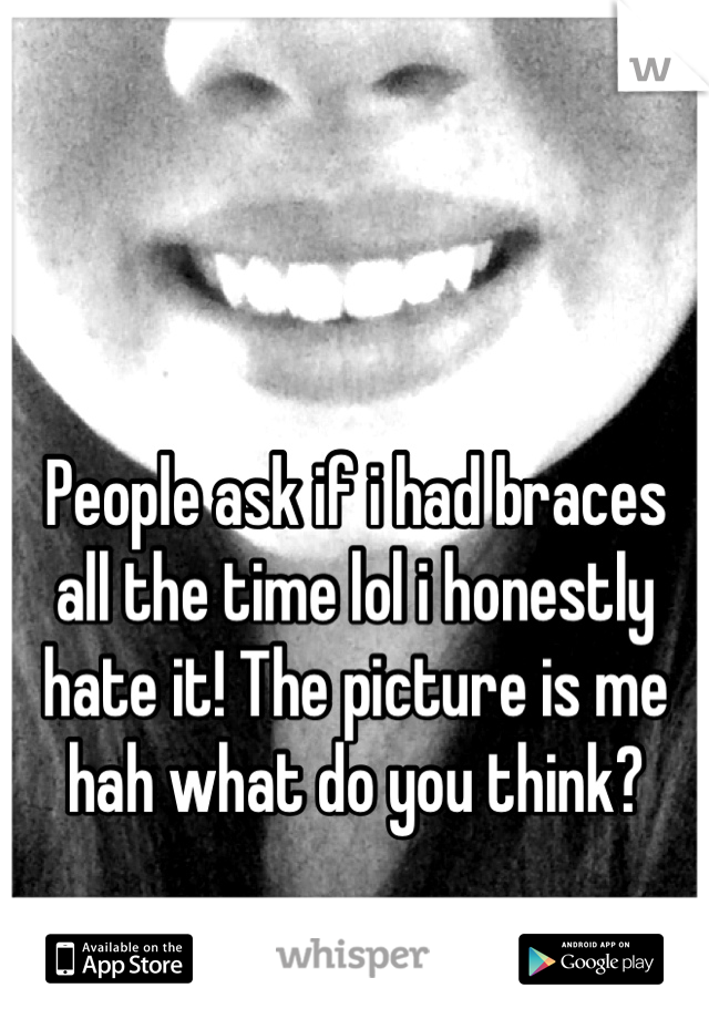 People ask if i had braces all the time lol i honestly hate it! The picture is me hah what do you think?