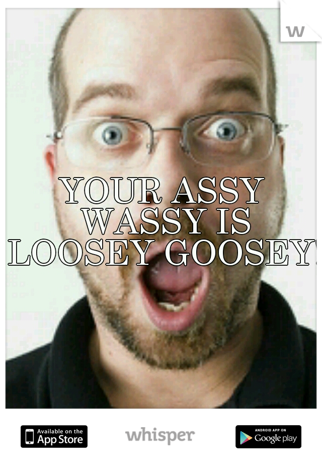 YOUR ASSY WASSY IS LOOSEY GOOSEY!
