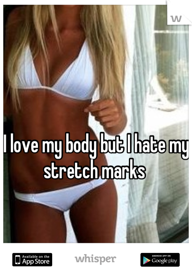 I love my body but I hate my stretch marks 