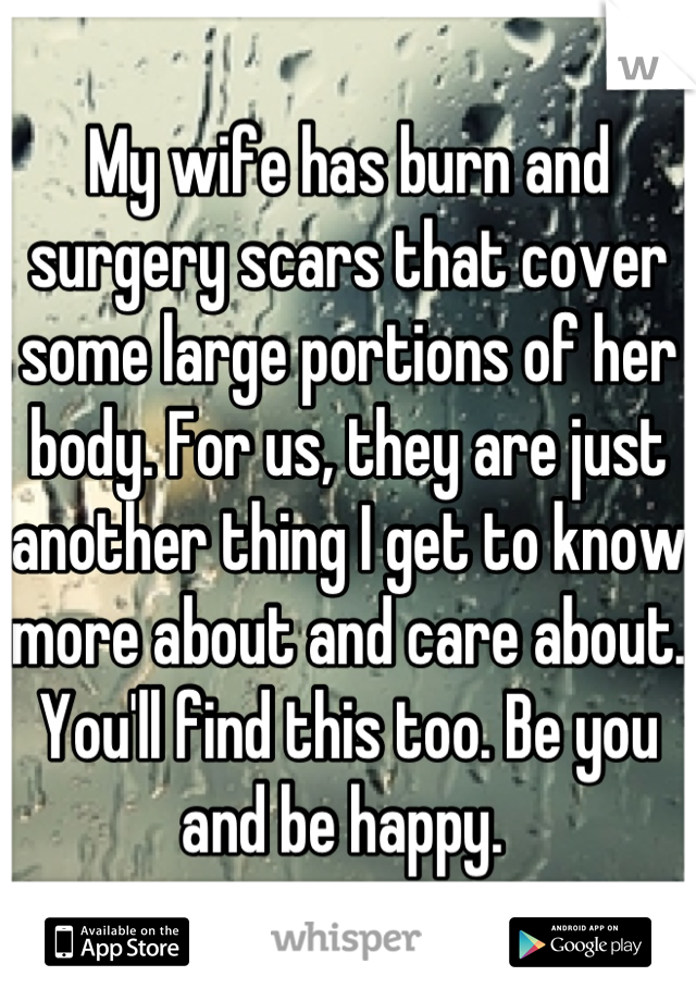 My wife has burn and surgery scars that cover some large portions of her body. For us, they are just another thing I get to know more about and care about. You'll find this too. Be you and be happy. 