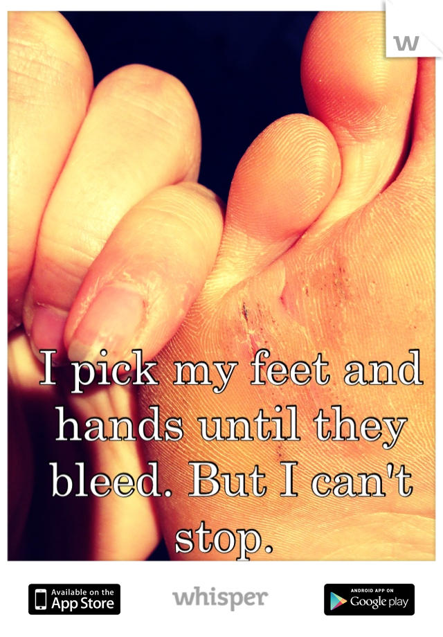 I pick my feet and hands until they bleed. But I can't stop. 