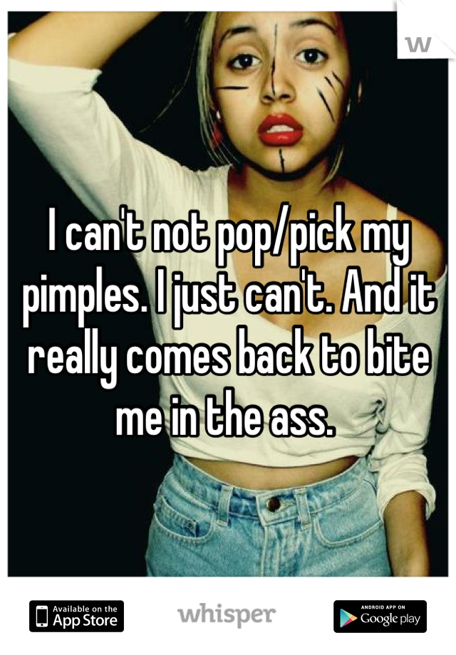 I can't not pop/pick my pimples. I just can't. And it really comes back to bite me in the ass. 