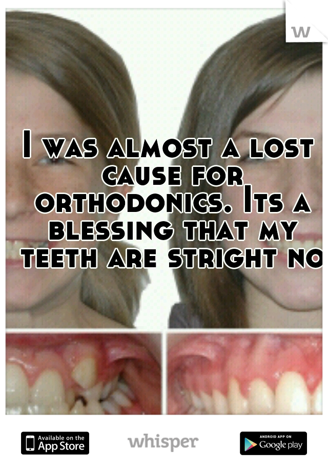 I was almost a lost cause for orthodonics. Its a blessing that my teeth are stright now