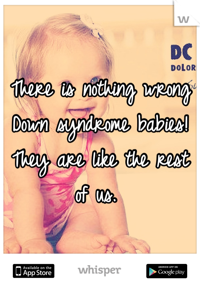 There is nothing wrong Down syndrome babies! They are like the rest of us. 
