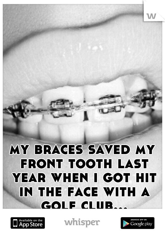my braces saved my front tooth last year when i got hit in the face with a golf club...