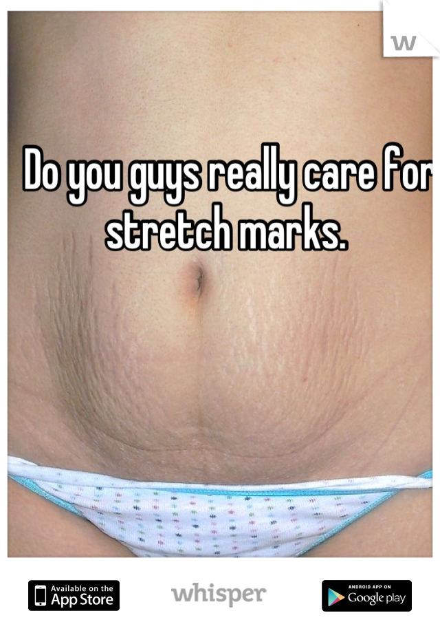 Do you guys really care for stretch marks. 