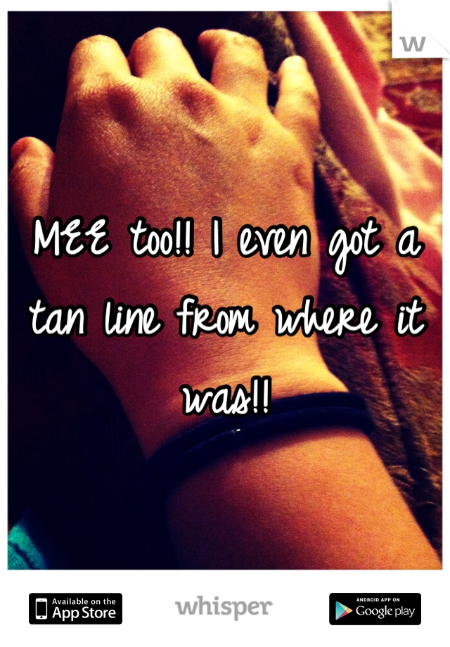 MEE too!! I even got a tan line from where it was!!