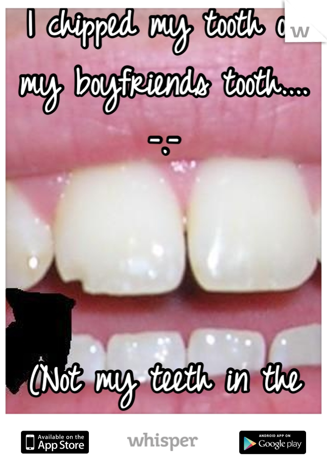 I chipped my tooth on my boyfriends tooth.... -.-



(Not my teeth in the pic)