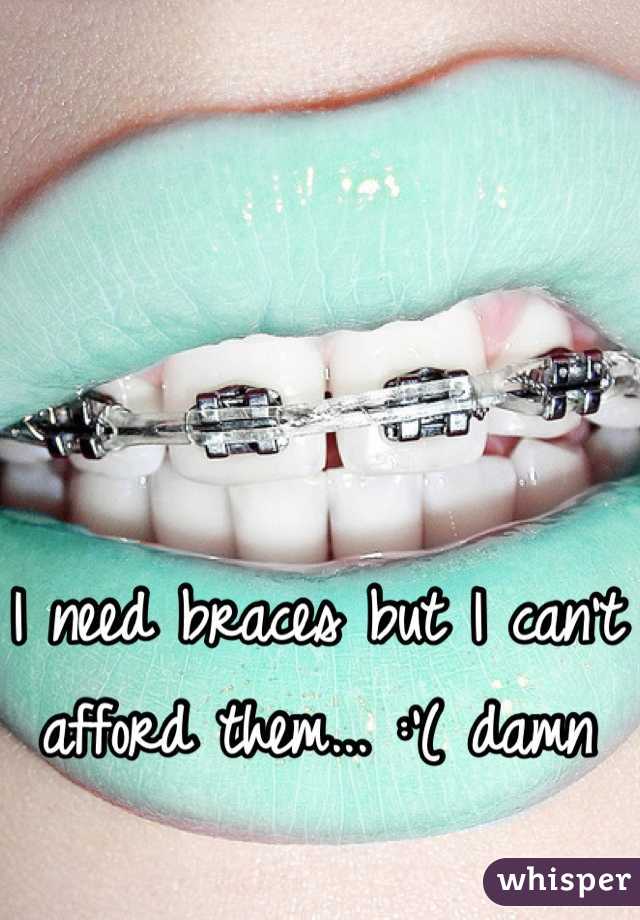 I need braces but I can't afford them... :'( damn