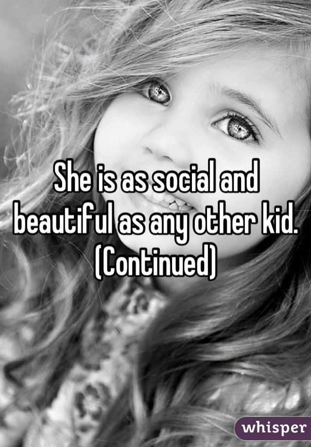 She is as social and beautiful as any other kid. (Continued)