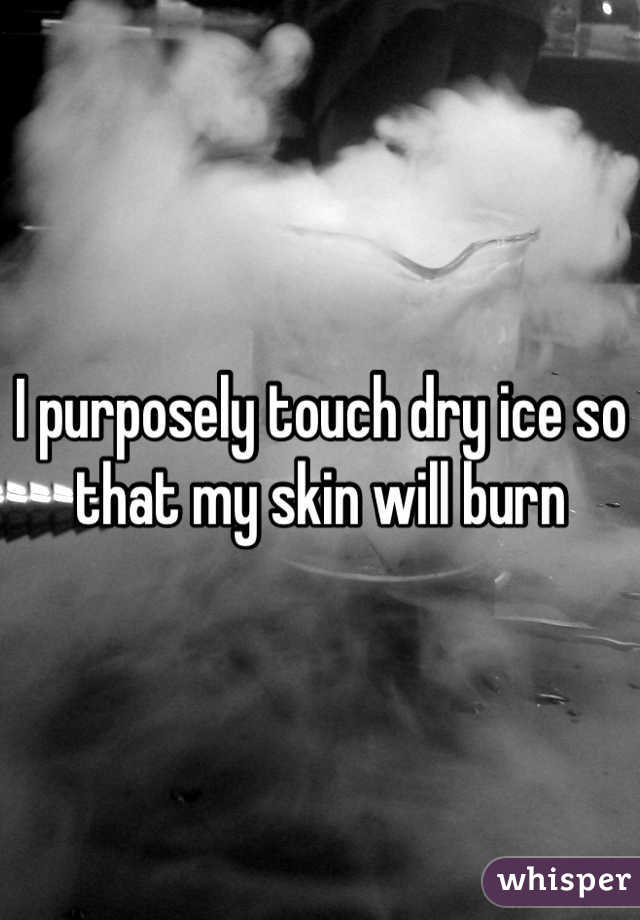 I purposely touch dry ice so that my skin will burn