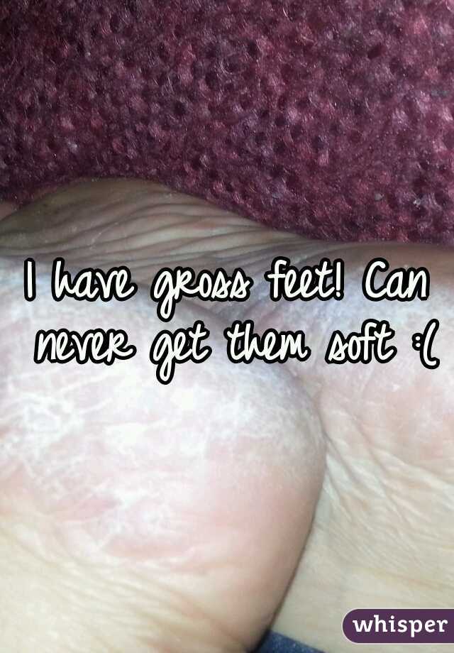 I have gross feet! Can never get them soft :(