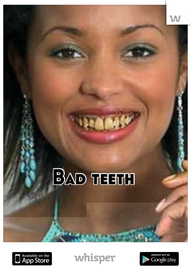 Bad teeth 