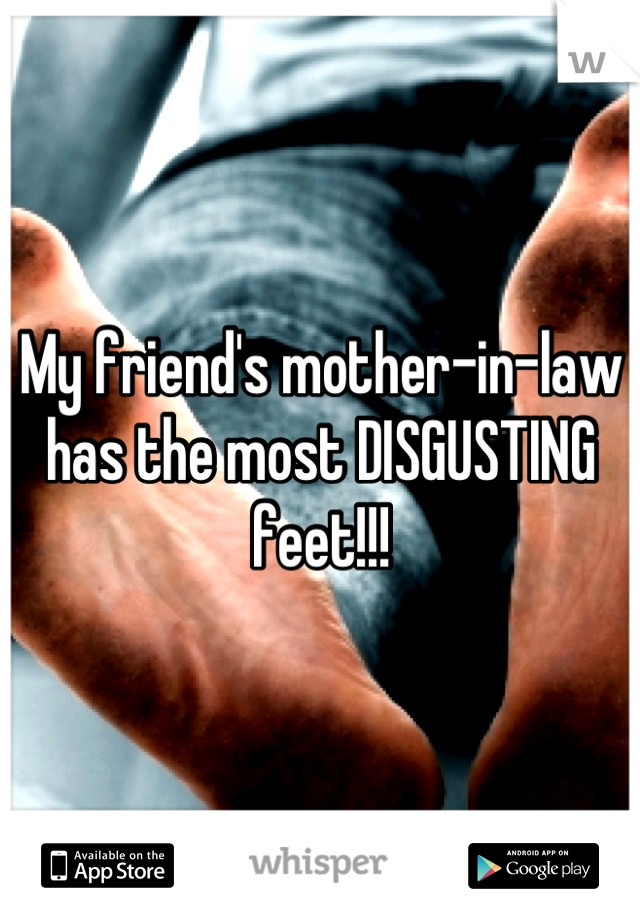 My friend's mother-in-law has the most DISGUSTING feet!!!