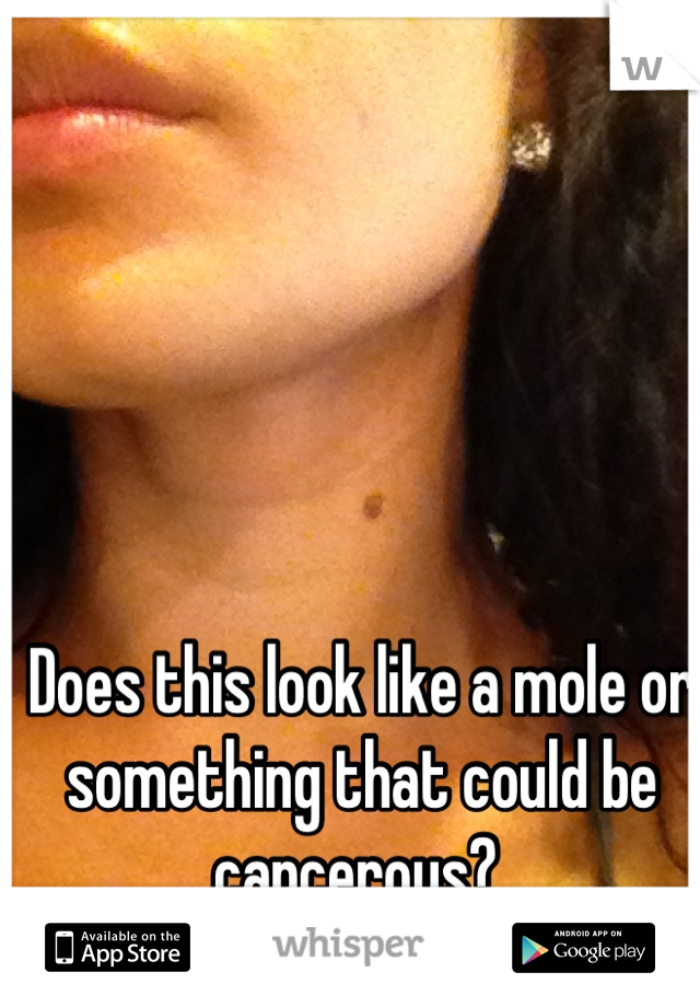 Does this look like a mole or something that could be cancerous? 