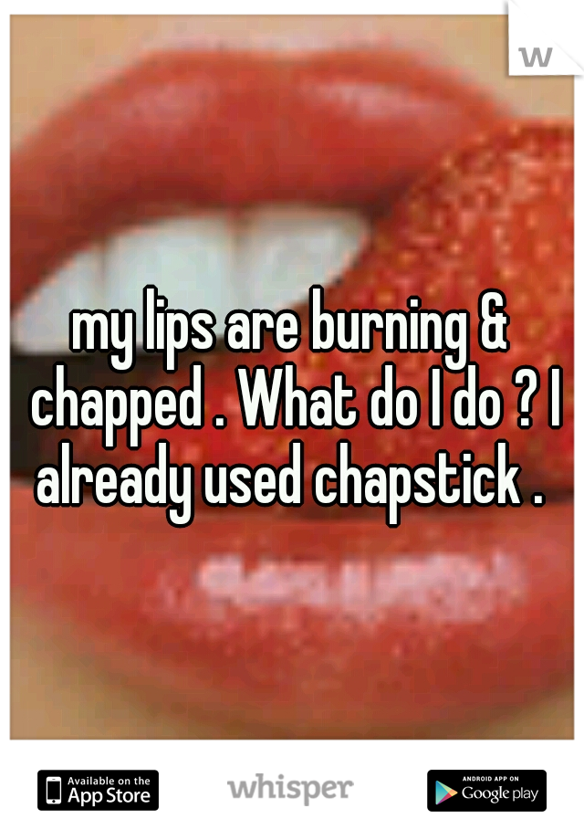 my lips are burning & chapped . What do I do ? I already used chapstick . 