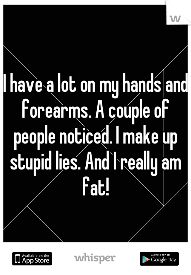I have a lot on my hands and forearms. A couple of people noticed. I make up stupid lies. And I really am fat!