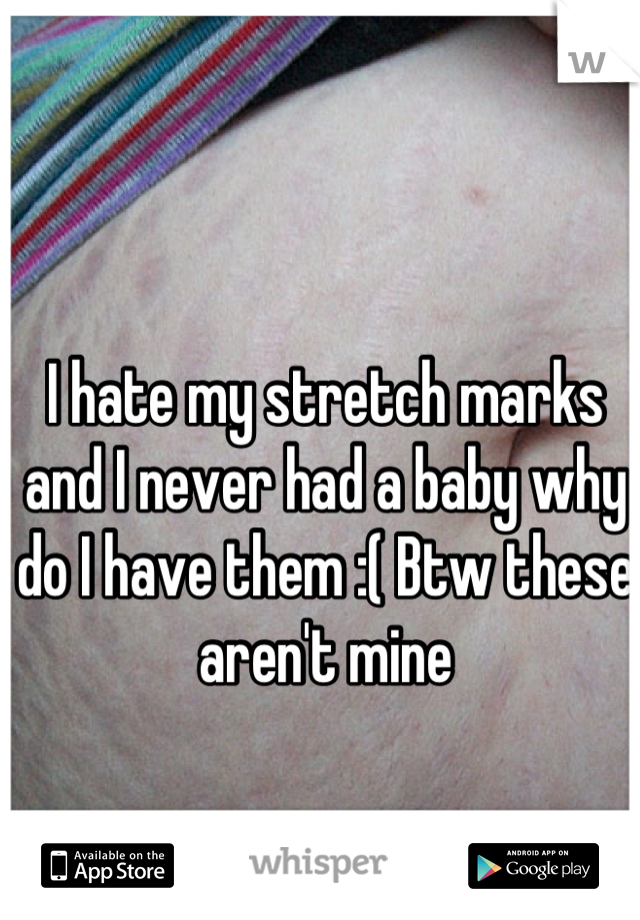 I hate my stretch marks and I never had a baby why do I have them :( Btw these aren't mine