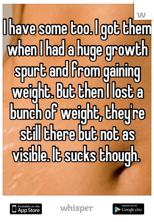 I have some too. I got them when I had a huge growth spurt and from gaining weight. But then I lost a bunch of weight, they're still there but not as visible. It sucks though. 