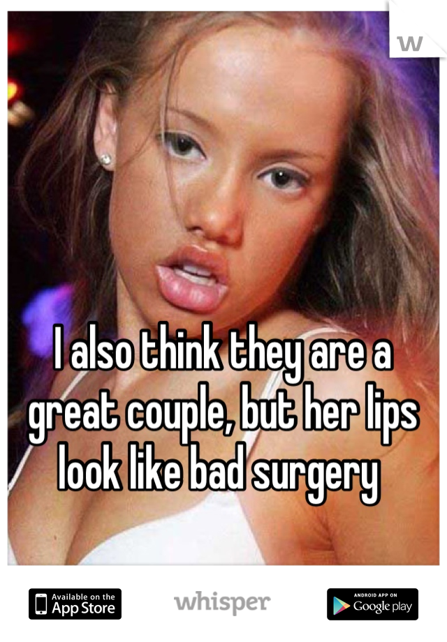I also think they are a great couple, but her lips look like bad surgery 