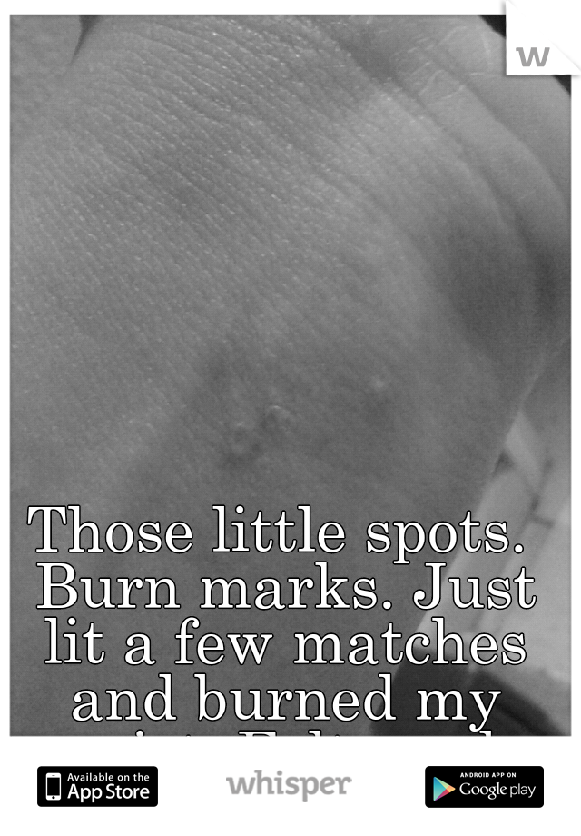 Those little spots. Burn marks. Just lit a few matches and burned my wrist. Felt good.