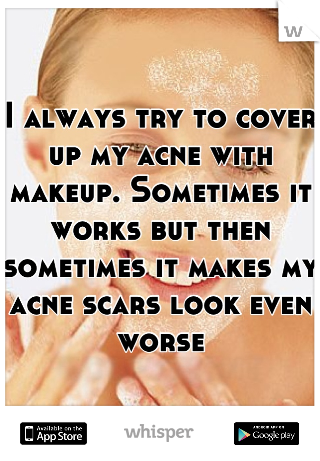 I always try to cover up my acne with makeup. Sometimes it works but then sometimes it makes my acne scars look even worse