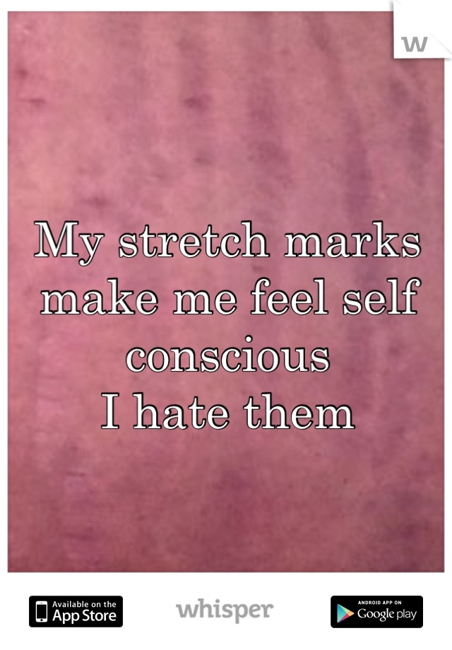 My stretch marks make me feel self conscious
I hate them