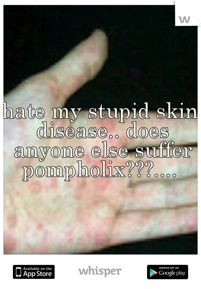 hate my stupid skin disease.. does anyone else suffer pompholix???.... 