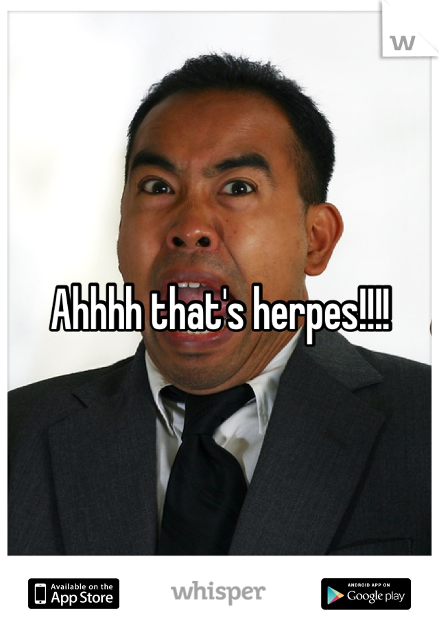 Ahhhh that's herpes!!!!