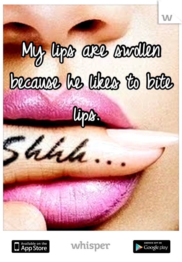 My lips are swollen because he likes to bite lips. 