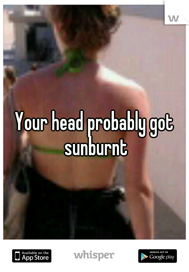 Your head probably got sunburnt