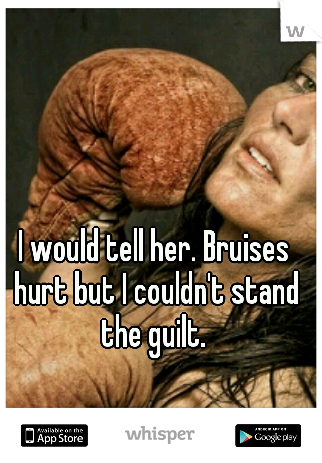 I would tell her. Bruises hurt but I couldn't stand the guilt. 