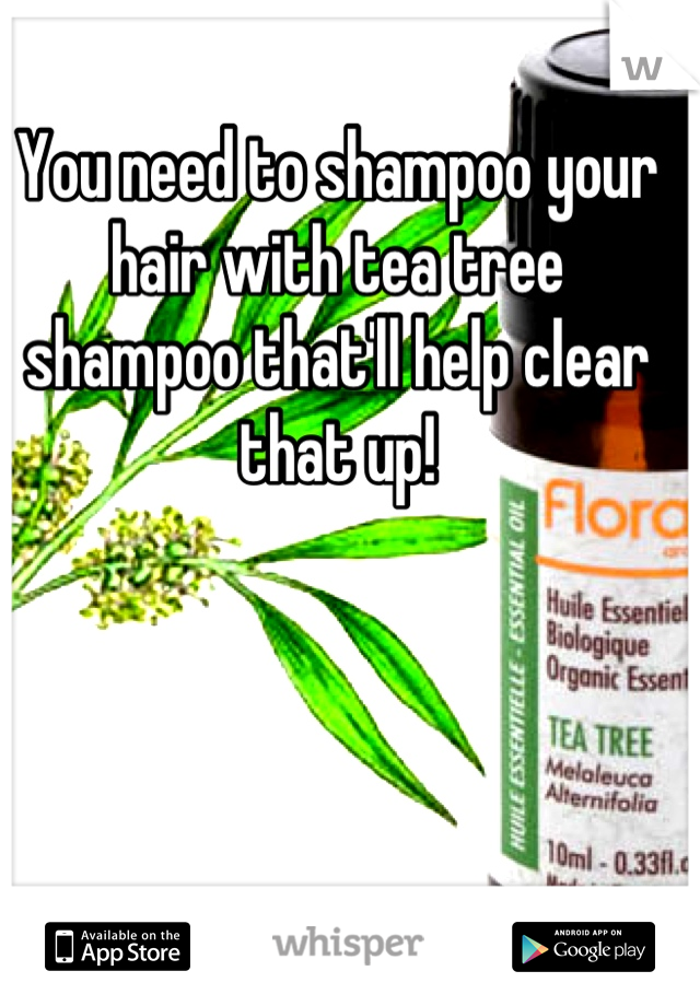 You need to shampoo your hair with tea tree shampoo that'll help clear that up!