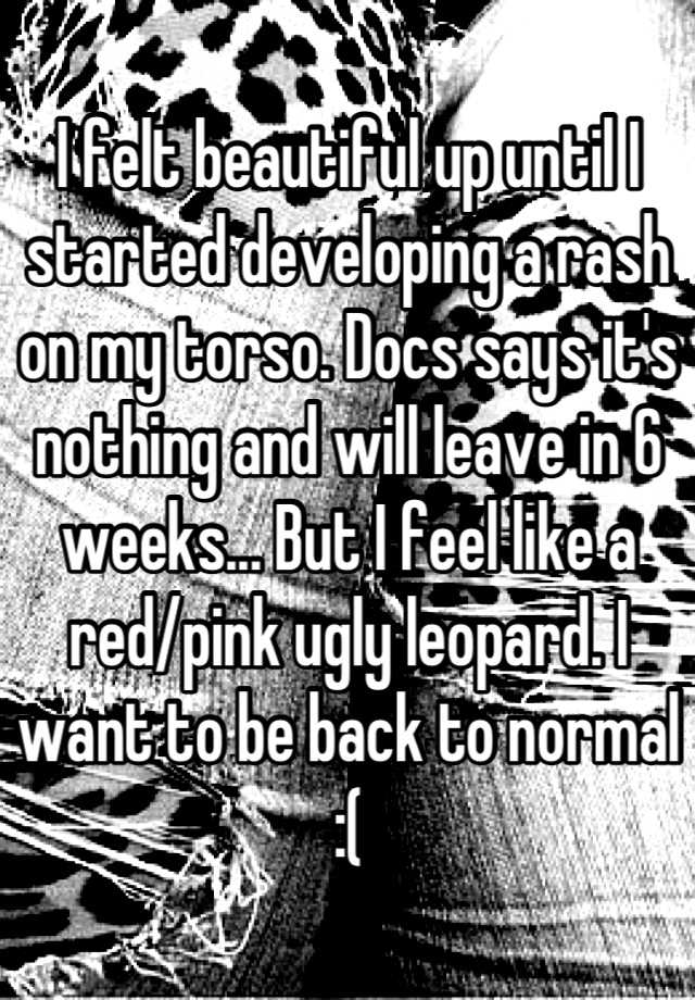 I felt beautiful up until I started developing a rash on my torso. Docs says it's nothing and will leave in 6 weeks... But I feel like a red/pink ugly leopard. I want to be back to normal :(