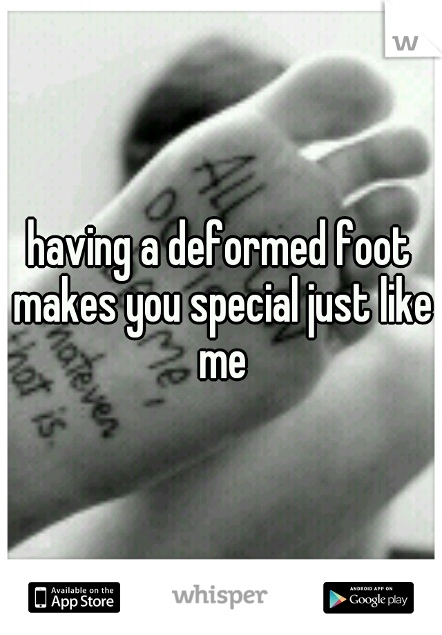 having a deformed foot makes you special just like me