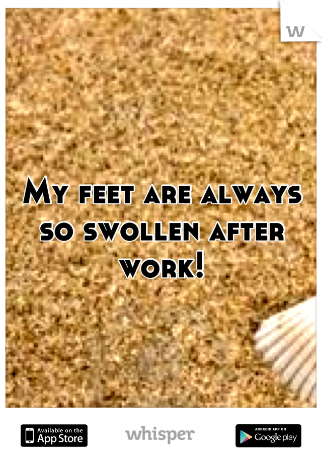 My feet are always so swollen after work!