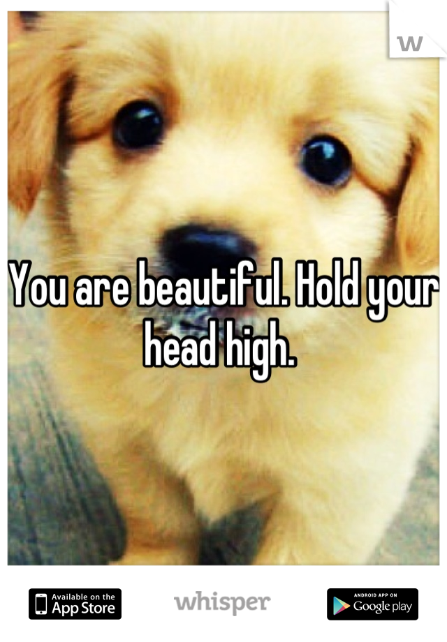 You are beautiful. Hold your head high. 