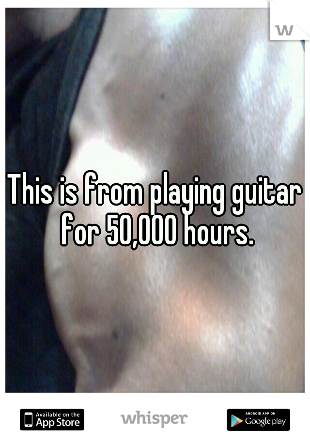 This is from playing guitar for 50,000 hours.