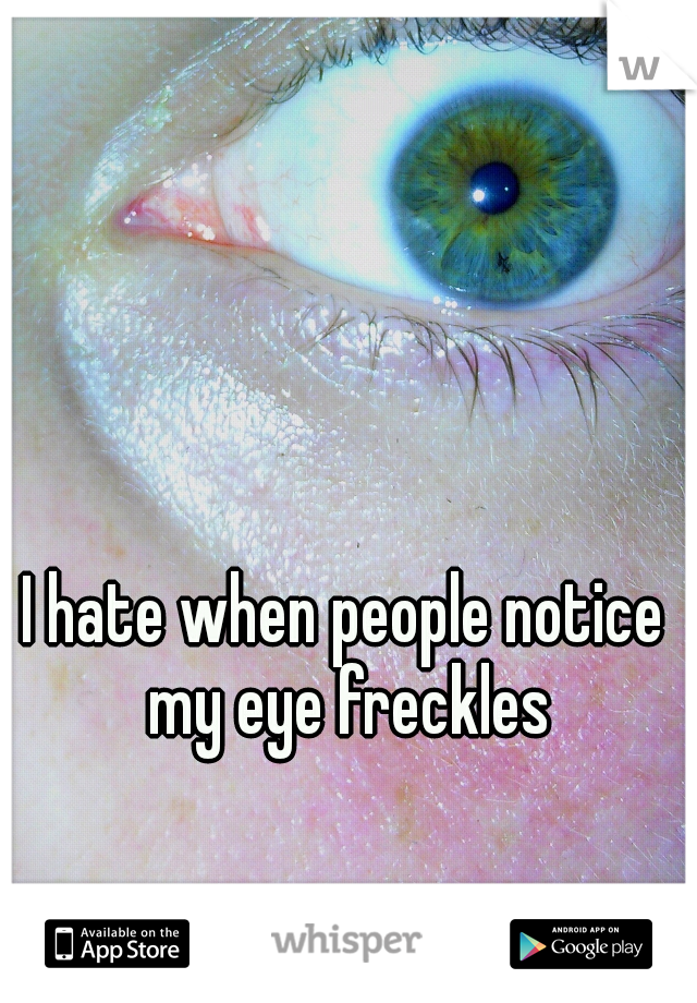 I hate when people notice my eye freckles