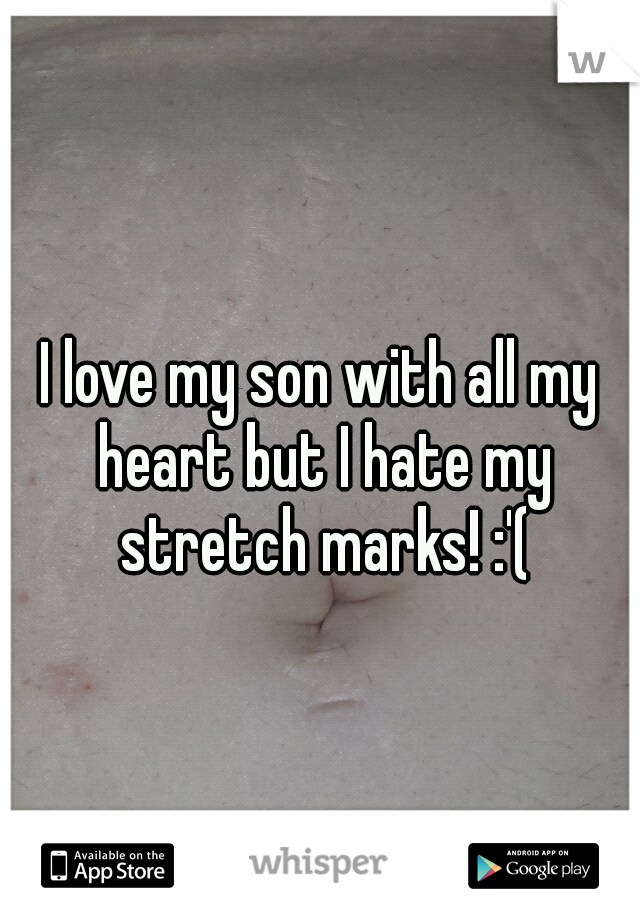 I love my son with all my heart but I hate my stretch marks! :'(