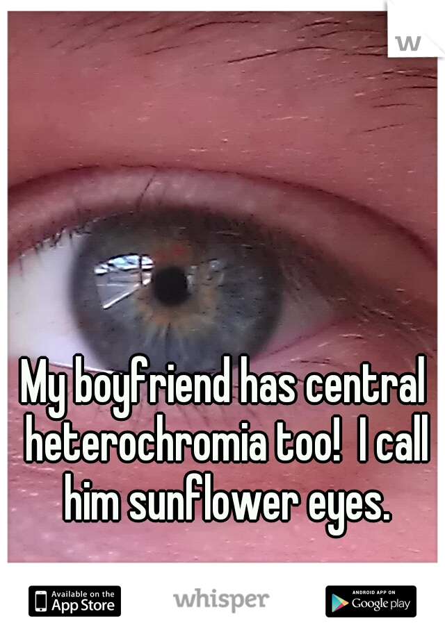 My boyfriend has central heterochromia too!  I call him sunflower eyes.