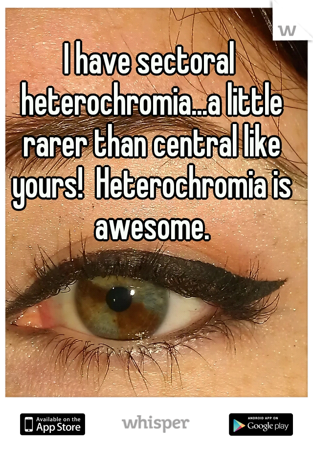 I have sectoral heterochromia...a little rarer than central like yours!  Heterochromia is awesome.