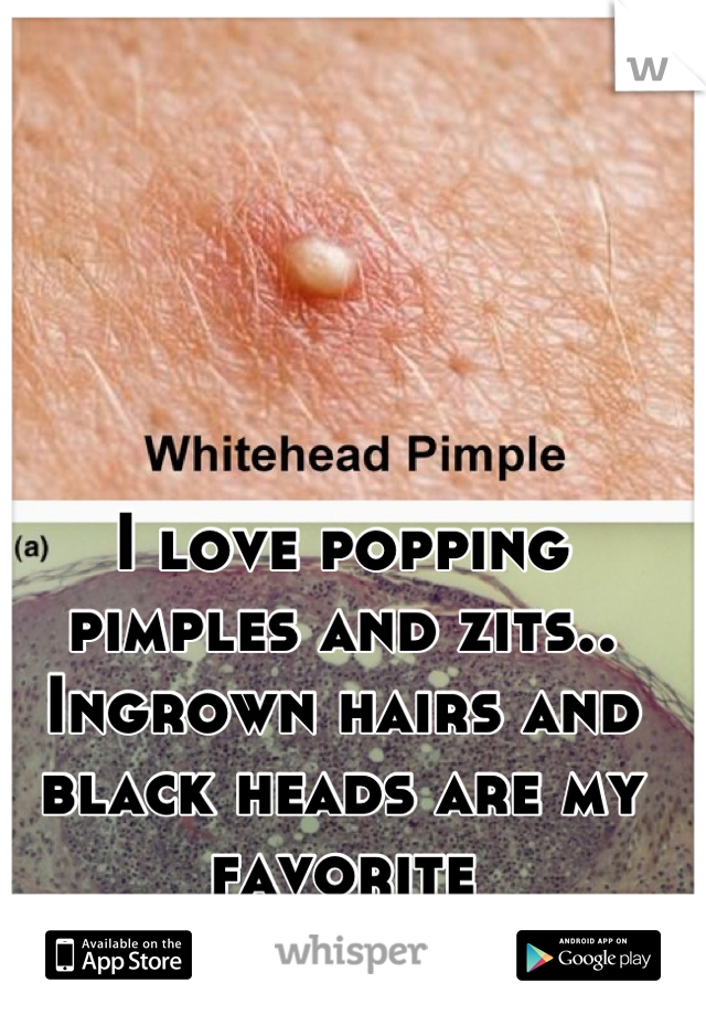 I love popping pimples and zits.. Ingrown hairs and black heads are my favorite
