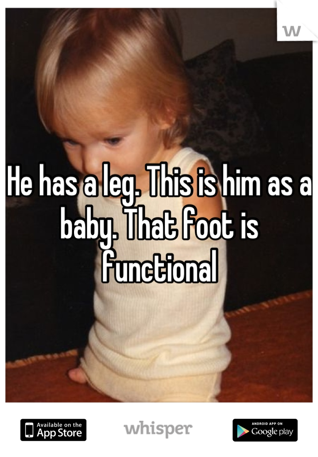 He has a leg. This is him as a baby. That foot is functional