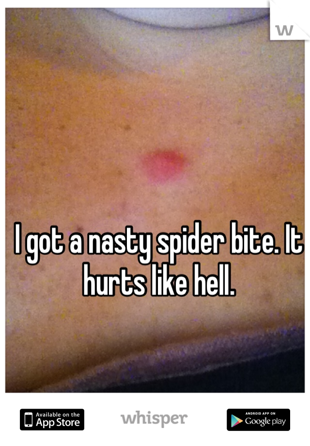 I got a nasty spider bite. It hurts like hell.