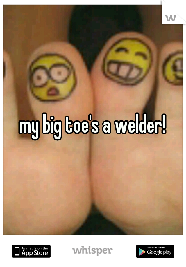 my big toe's a welder!