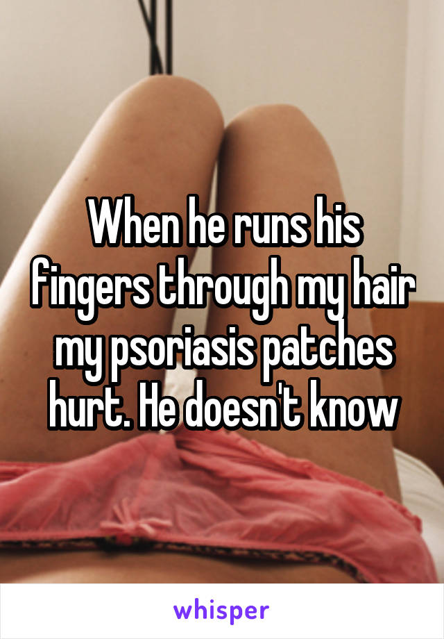 When he runs his fingers through my hair my psoriasis patches hurt. He doesn't know