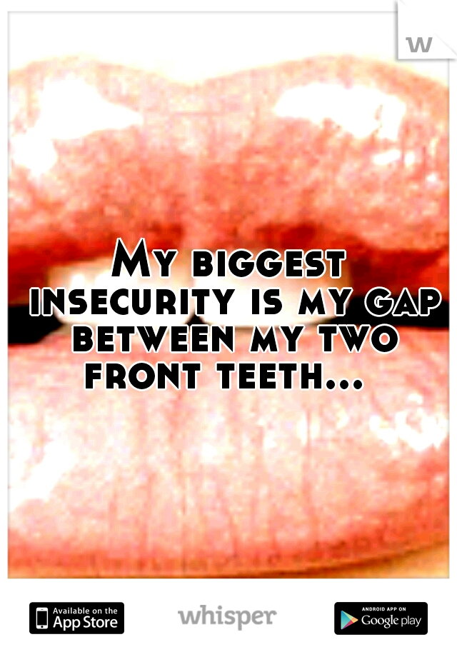 My biggest insecurity is my gap between my two front teeth...
